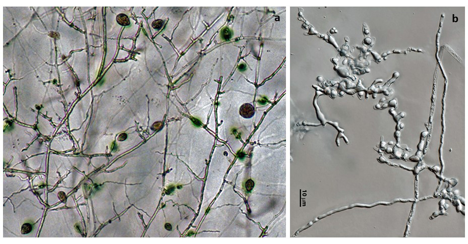   Phytophthora pseudosyringae  (ex-type CPHST BL 51G) asexual phase: (a) sporangia in sporangiophores, (b) coralloid mycelia; photos by Gloria Abad, USDA-APHIS-PPQ. 
